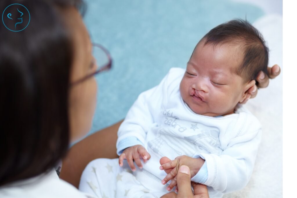 infant with cleft palate showing nasal asymmetry and structural differences before nasal surgery treatment