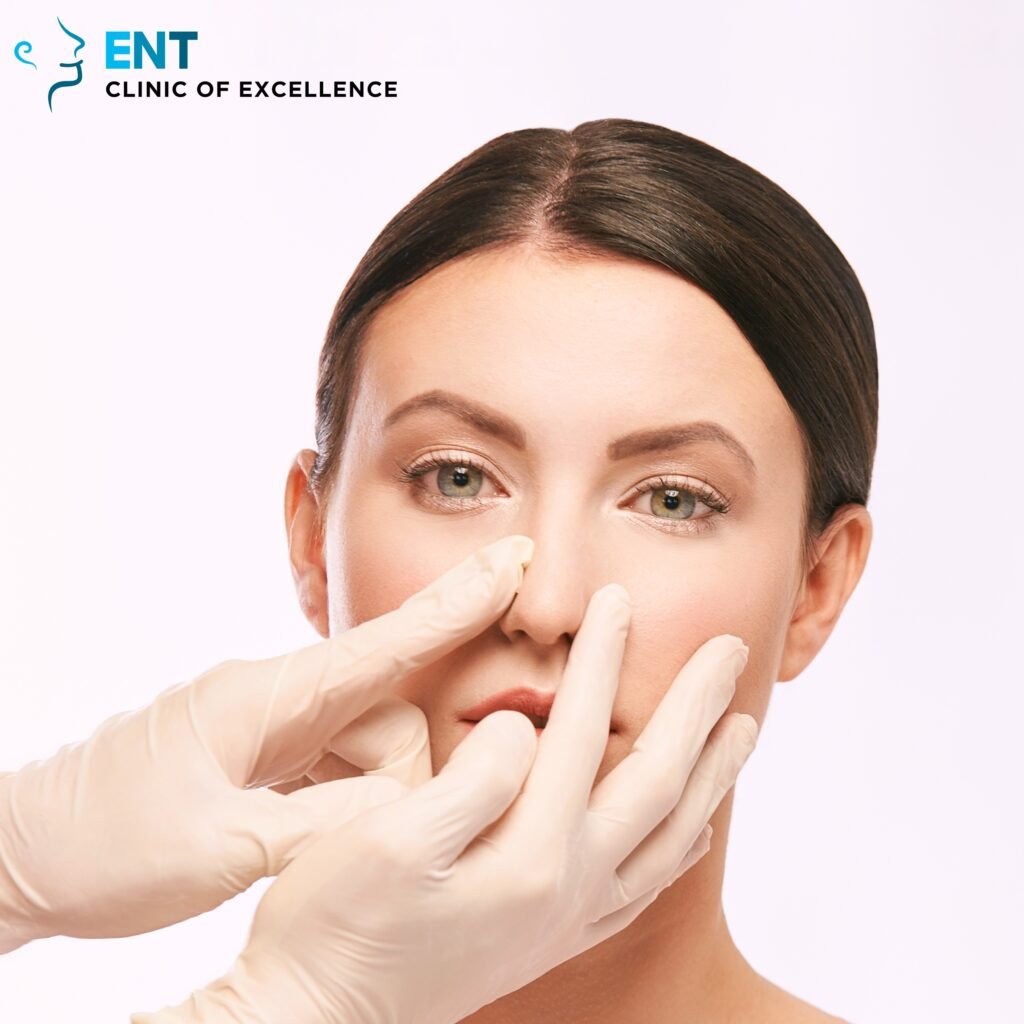 Answering the Most Common Questions About Rhinoplasty