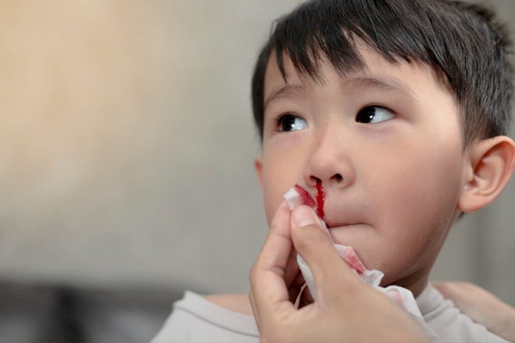 Understanding Epistaxis in Kids: Causes and Finding the Best ENT Doctor in Dubai