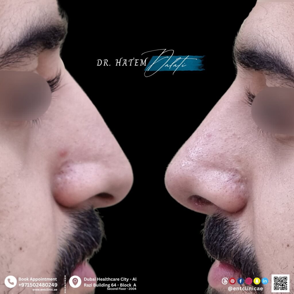 Your one-stop clinic for all ENT services and adult surgeries, including rhinoplasty. Let us take care of your health and confidence! (1)