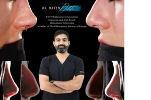 DR HATEM DALATI RHINOPLASTY NOSE JOB REVISION DUBAI UAE NATURAL LOOK PRICE ENT CONSULTANT SURGEON SURGERY